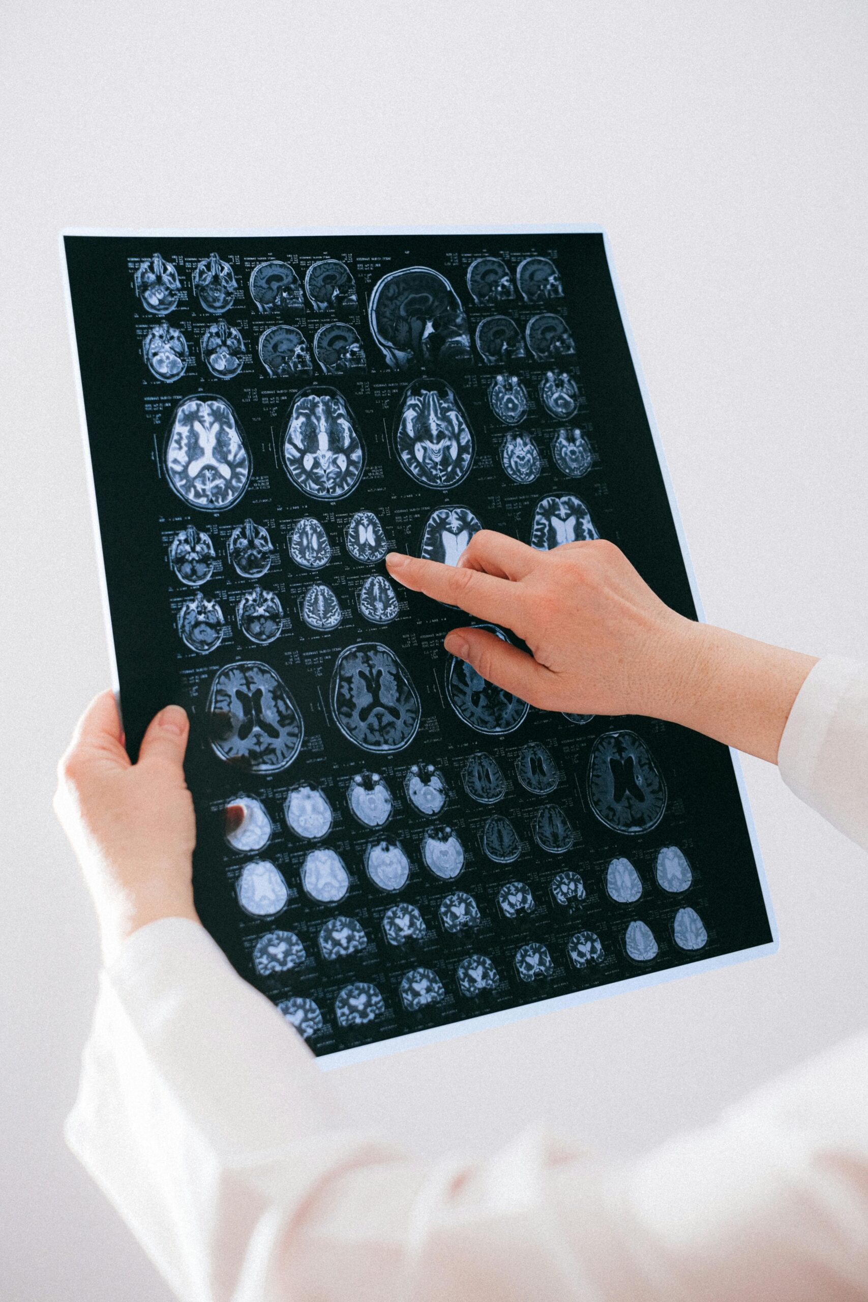 Neurorrehabilitación robótica en la ELA en Colombia: innovación para la calidad de vida